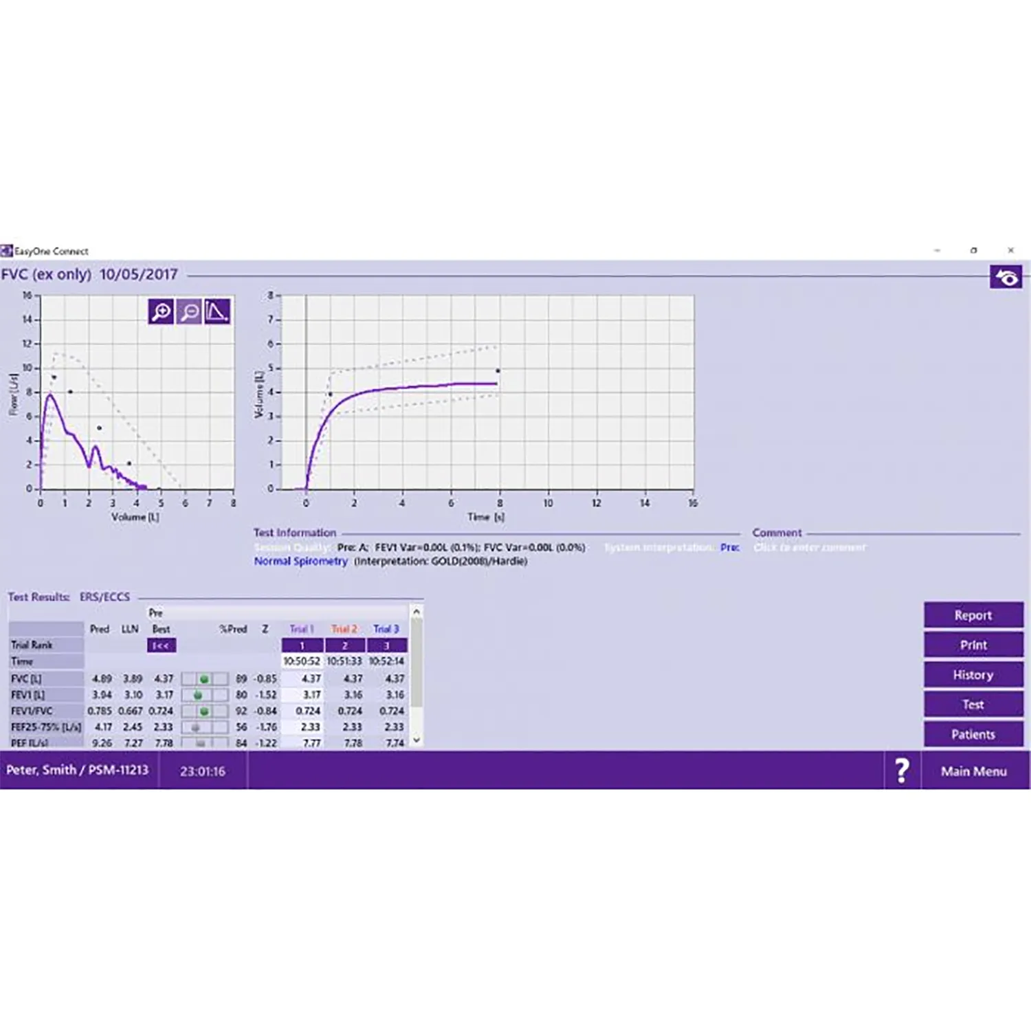 Easy on-PC Lightweight Spirometer with Diagnostic Software