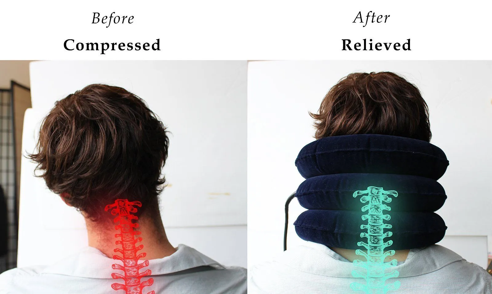 Inflatable Cervical Neck Traction Device - Instant Neck Pain Relief